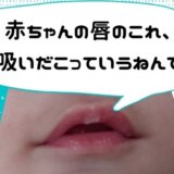 吸いだこができた赤ちゃんの唇
