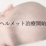 絶壁のヘルメット治療開始します